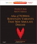 Atlas of normal roentgen variants that may simulate disease