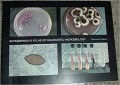 Atlas of Diagnostic Microbiology