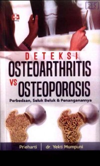 Deteksi Osteoarthritis Vs Osteoporosis Perbedaan, Seluk Beluk dan Penanganannya