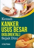 Kenali Kanker Usus Besar (Kolorektal) Sejak Dini