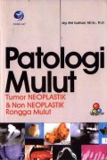 Patologi Mulut: Tumor Neoplastik dan Non Neoplastik Rongga Mulut