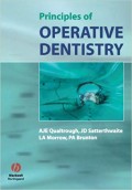Principles of Operative Dentistry